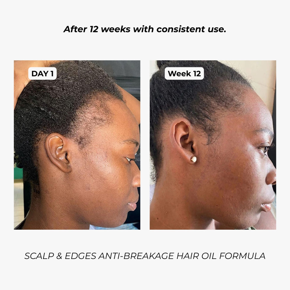 Before and after results